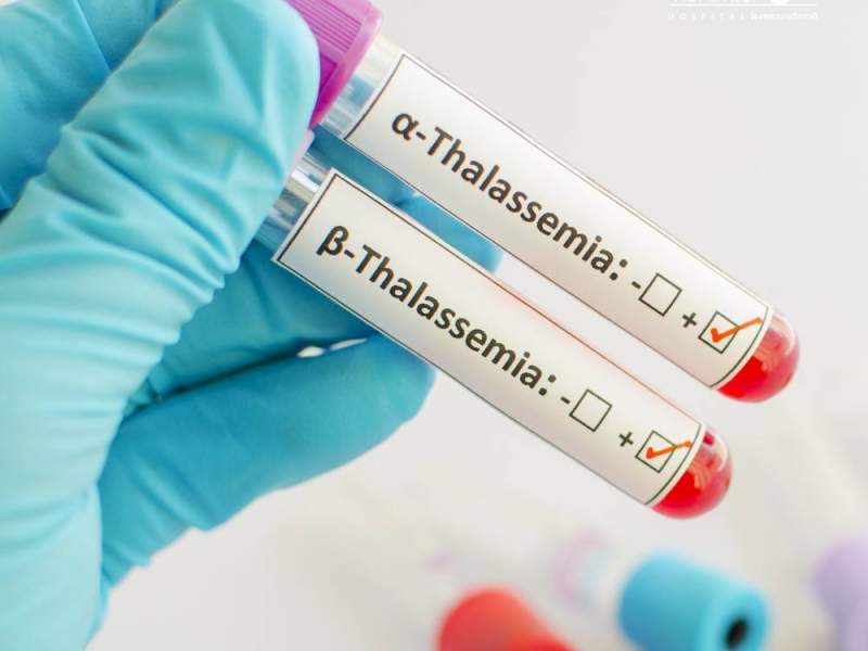 Efek Negatif Teknologi Digital pada Anak